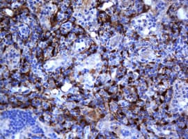 Selenium Binding Protein 1 Antibody (clone OTI3H1)