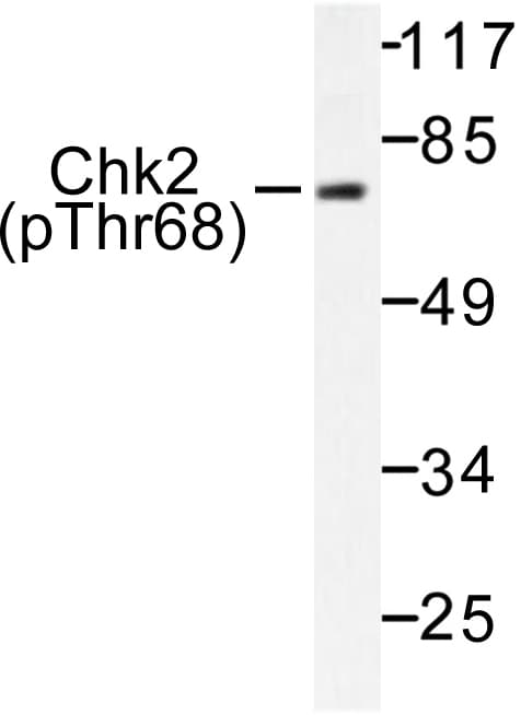 CHEK2 / CHK2 Antibody (phospho-Thr68)