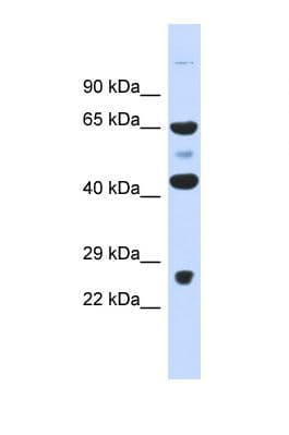 KBTBD10 / Sarcosin Antibody (aa213-262)