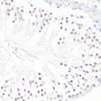 GLI / GLI1 Antibody