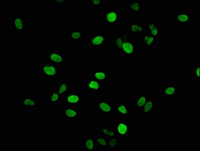 HIST1H1E Antibody