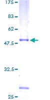 Human RHOD Protein (Recombinant GST)