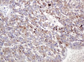 BBOX1 / BBOX Antibody (clone OTI2F4)