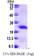 Human CARHSP1 Protein (Recombinant His)