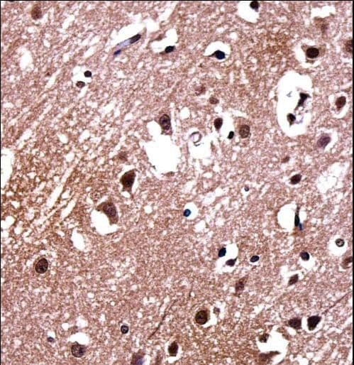 LDB2 Antibody (aa314-342)