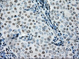 Monoclonal Mouse anti-Human BRAF / B-Raf Antibody (clone OTI4G6, IHC, WB)