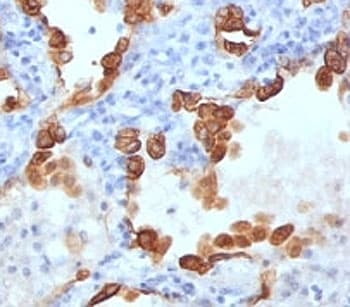 Cytokeratin 8+18 Antibody (clone B22.1 + B23.1, Ready-to-Use)