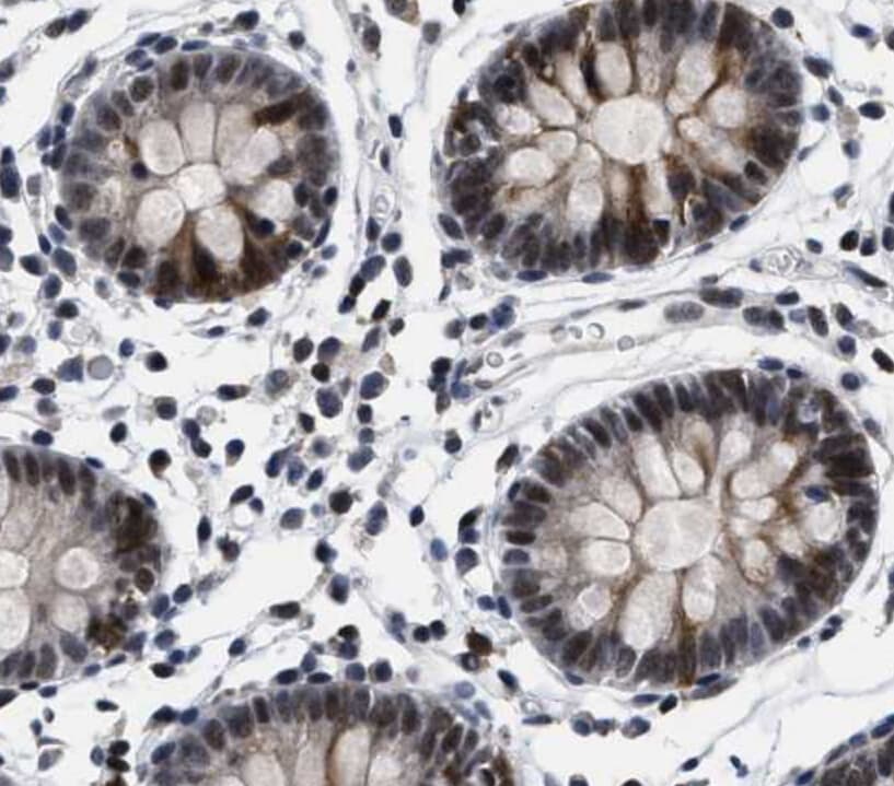 Polyclonal Rabbit anti-Human HIF1A / HIF1 Alpha Antibody (IHC, IF, WB)