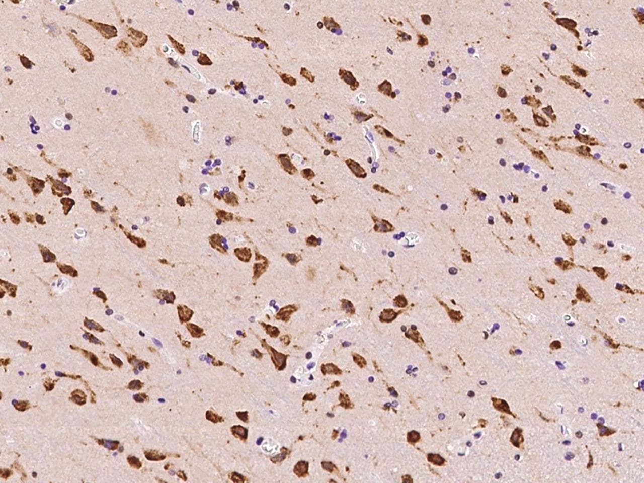 TMEM38A Antibody