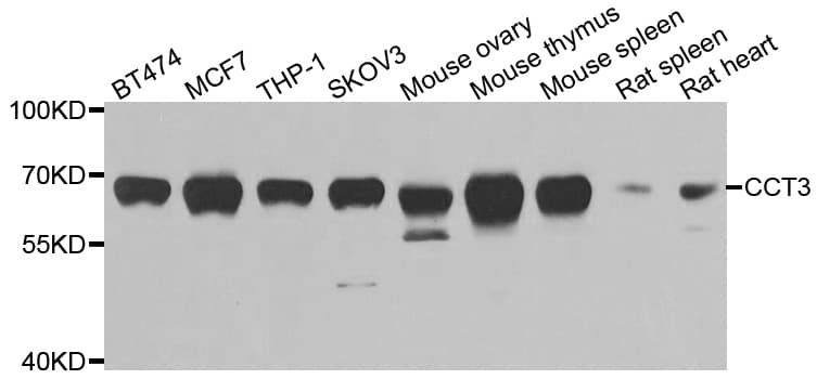 Polyclonal Rabbit anti-Human CCT3 Antibody (IHC, IF, WB)