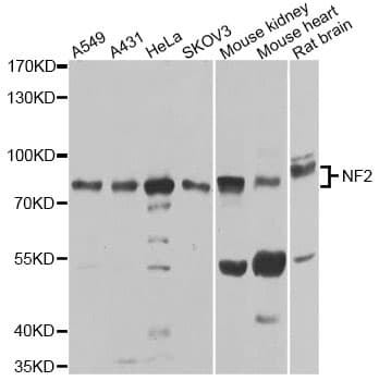 NF2 / Merlin Antibody