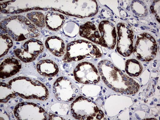 PIK3CD / PI3K Delta Antibody (aa286-610, clone OTI6A12)