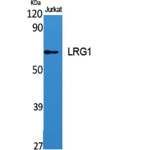 Polyclonal Rabbit anti-Human LRG1 / LRG Antibody (C-terminal, WB)