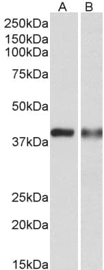 IHC-plus™ Polyclonal Goat anti-Human CAPG Antibody (aa147-159, IHC, WB)