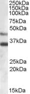 IHC-plus™ ARSB / Arylsulfatase B Antibody (aa359-372)