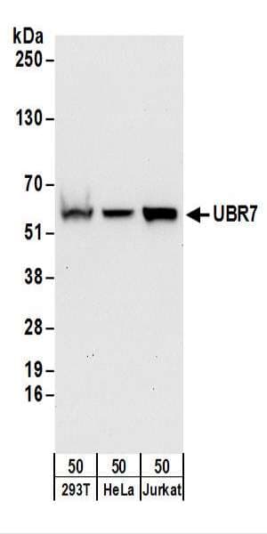 IHC-plus™ UBR7 / C14orf130 Antibody (aa1-50)