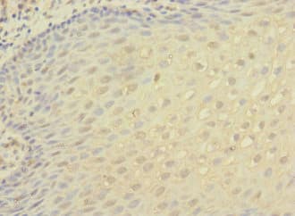 Polyclonal Rabbit anti-Human ITGAX / CD11c Antibody (IHC, IF, WB)