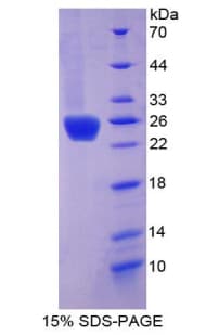 Rat GH / Growth Hormone Protein (Recombinant His-T7)