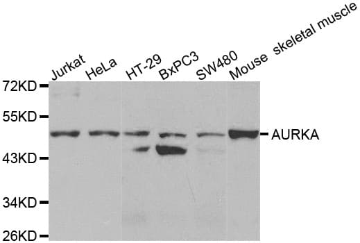 AURKA / Aurora-A Antibody