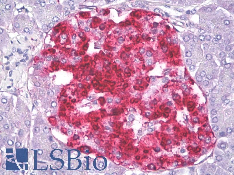IHC-plus™ IGFBP7 / TAF Antibody