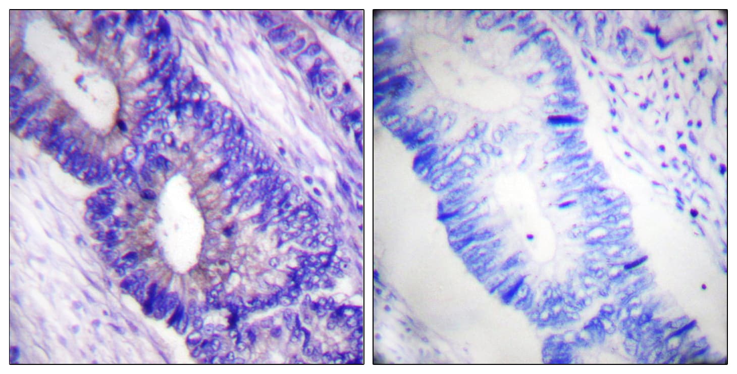 PRKACA + PRKACB Antibody (phospho-Thr197)