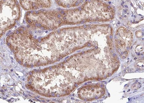 Polyclonal Rabbit anti-Human SEC61G Antibody (IHC, WB)