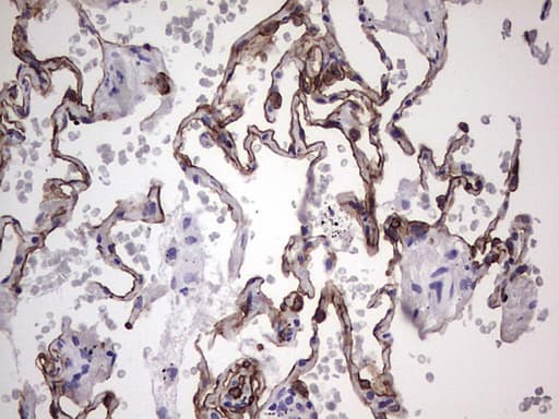 Monoclonal Mouse anti-Human KRT19 / CK19 / Cytokeratin 19 Antibody (clone OTI1F5, aa240-390, IHC, WB)