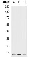 Polyclonal Rabbit anti-Human IL5 Antibody (Internal, WB)