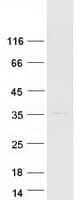 Human MRPL19 Protein (Recombinant Myc-DDK (Flag))