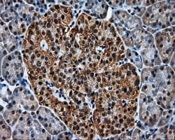 Monoclonal Mouse anti-Human MCL1 / MCL 1 Antibody (clone 10C5, Carrier-free, IHC, IF, WB)