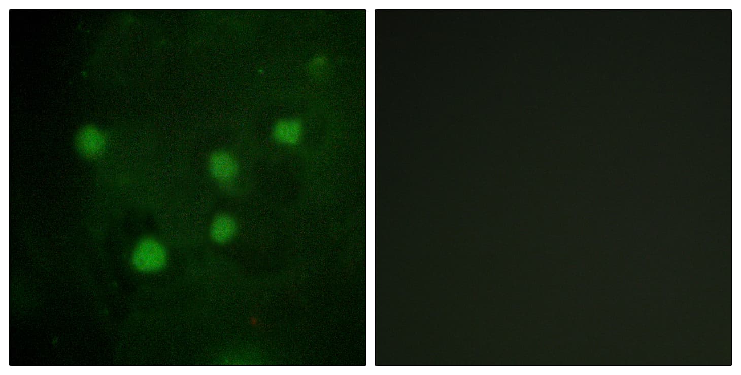 ARID1B / BAF250B Antibody (aa1371-1420)