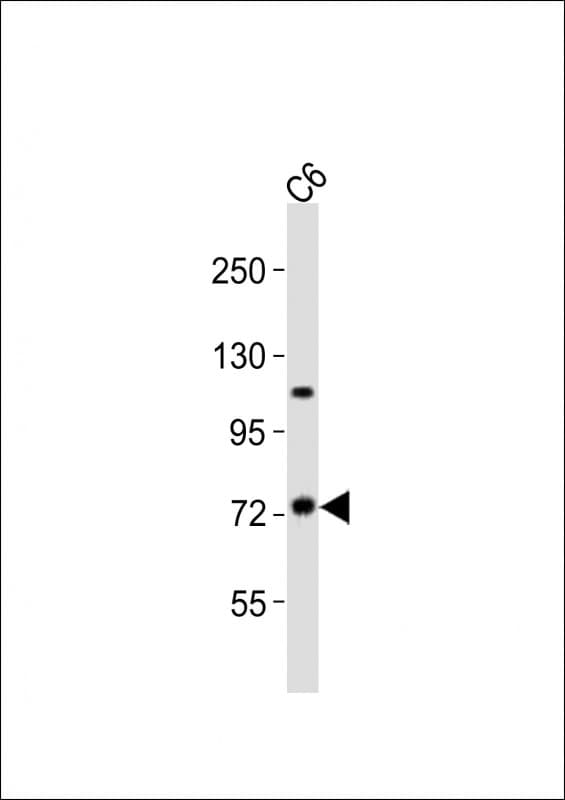Polyclonal Rabbit anti-Human TAB2 Antibody (aa646-680, WB)