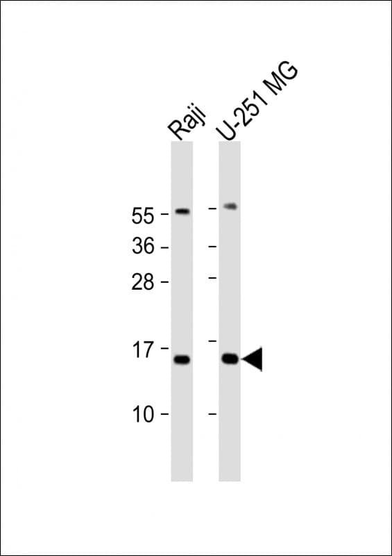 DNT / NT5C Antibody (N-Terminus)