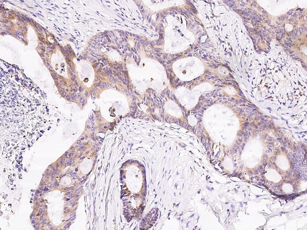RPS6 / Ribosomal Protein S6 Antibody