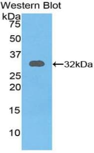 RYK Antibody (aa287-533)