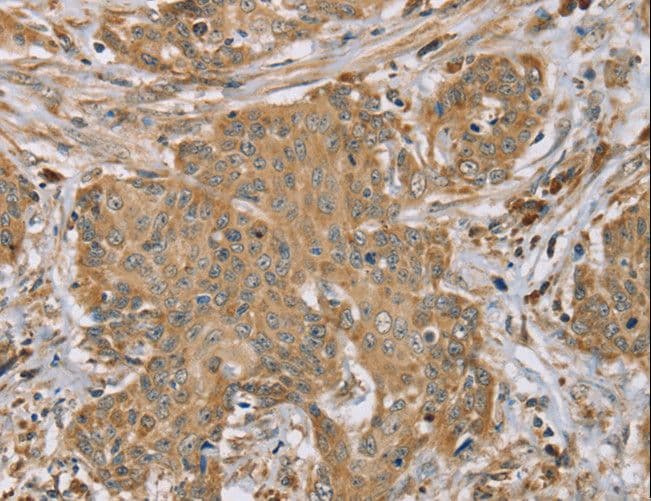 Polyclonal Rabbit anti-Human RNF148 Antibody (IHC)