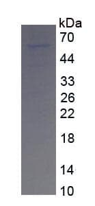 Human FGF10 Protein (Recombinant)
