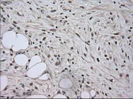 SATB1 Antibody (clone OTI13D6)