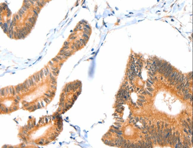 Polyclonal Rabbit anti-Human ACOX3 Antibody (IHC)