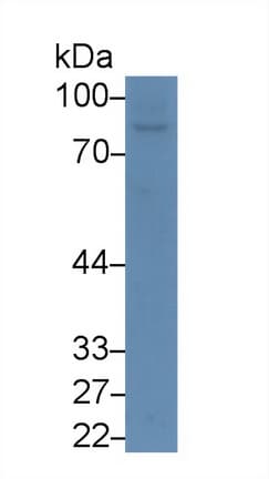 DPP4 / CD26 Antibody (aa631-760)