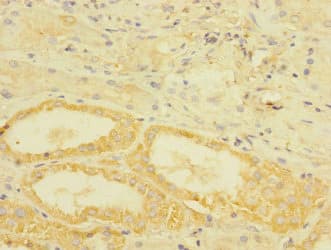 Polyclonal Rabbit anti-Human Betaglycan / TGFBR3 Antibody (IHC, WB)