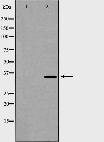 ANXA5 / Annexin V Antibody