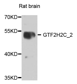 GTF2H2C_2 / GTF2H2D Antibody