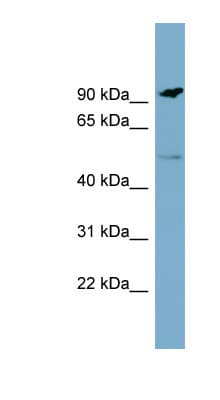 MARCO Antibody (aa71-120)