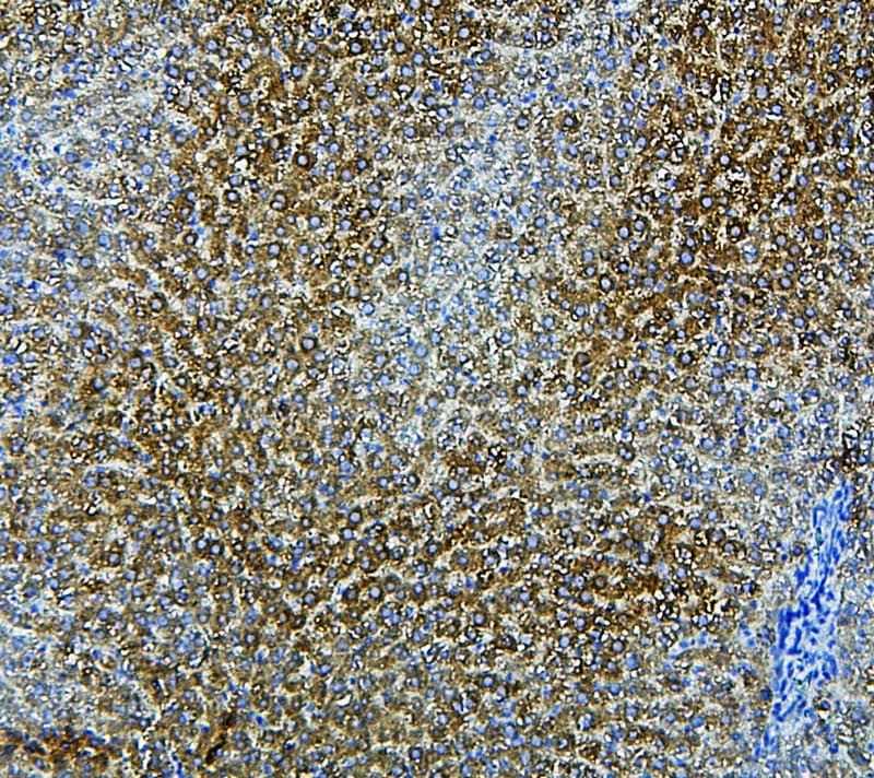 CYP2E1 Antibody (aa94-112)