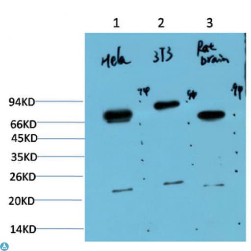 Monoclonal Mouse anti-Human Ubiquitin Antibody (IHC, WB)