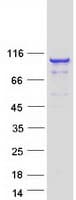 Human Villin-Like / VILL Protein (Recombinant Myc-DDK (Flag))