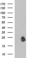 LOH12CR1 Antibody (clone OTI1E1)