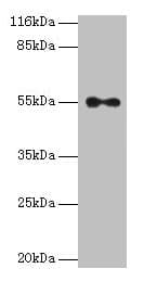 Polyclonal Rabbit anti-Human THRA / THR Alpha Antibody (aa1-490, IHC, WB)
