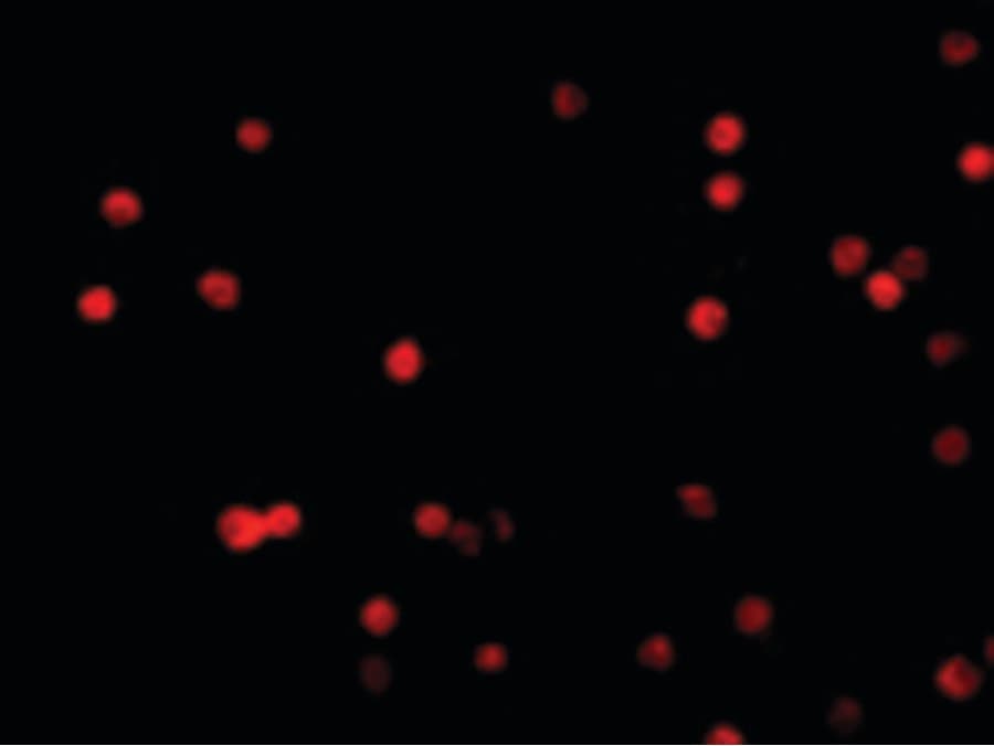 IHC-plus™ Polyclonal Rabbit anti-Human CFLAR / FLIP Antibody (IHC, IF, WB)